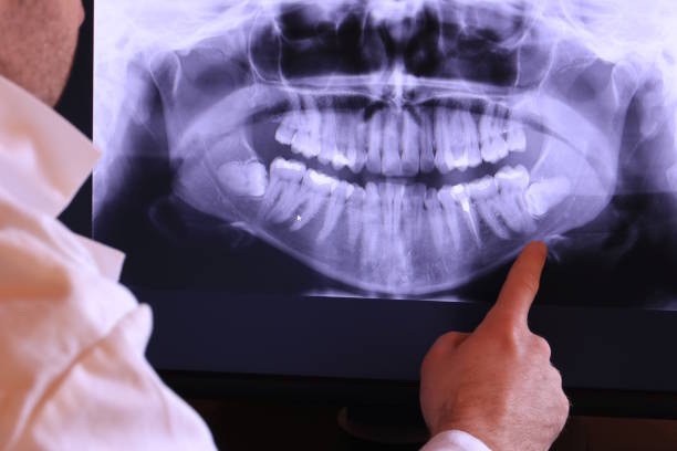 Best Walk-In Emergency Dentist in Russiaville, IN